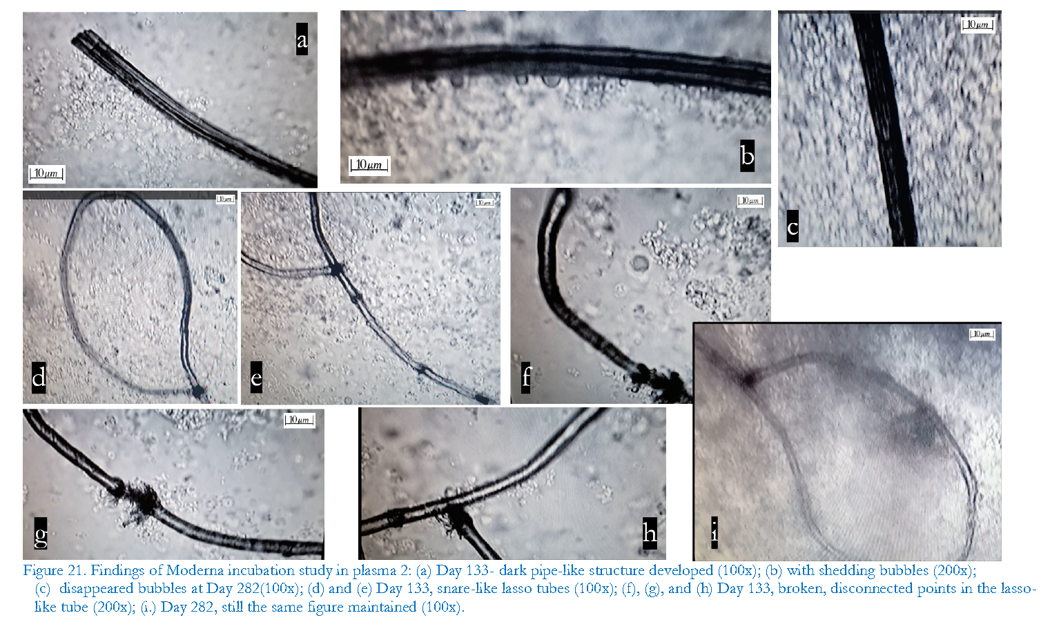 Showing whip-like structures forming in blood taken from a susceptible patient, after adding Moderna vax contents to it